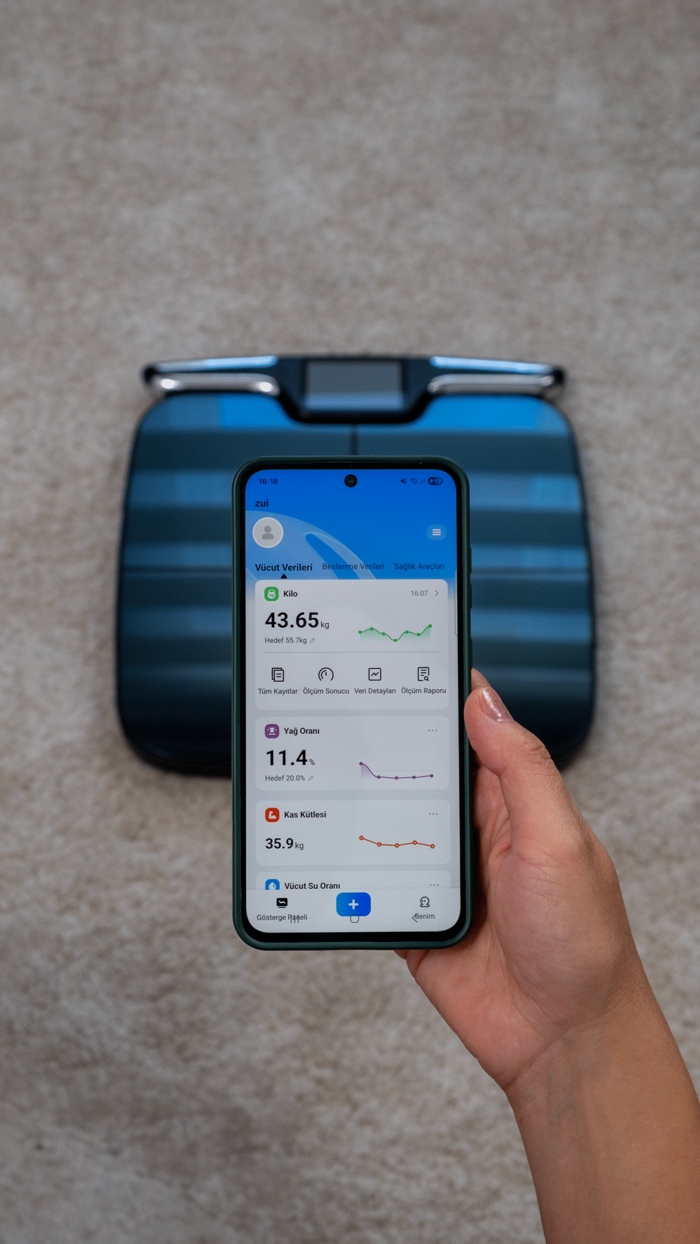 Form IQ Segmental Analiz